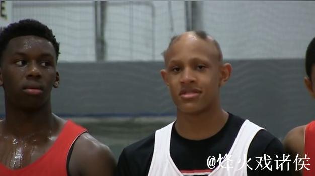 从脱发困扰到撑伞助人：乔丹沃尔什化身无眉侠士